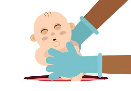 Birth factors influence infant gut microbiome, risk of obesity & allergies